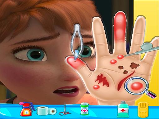 anna-frozen-hand-doctor-fun-games-for-girls-onlin