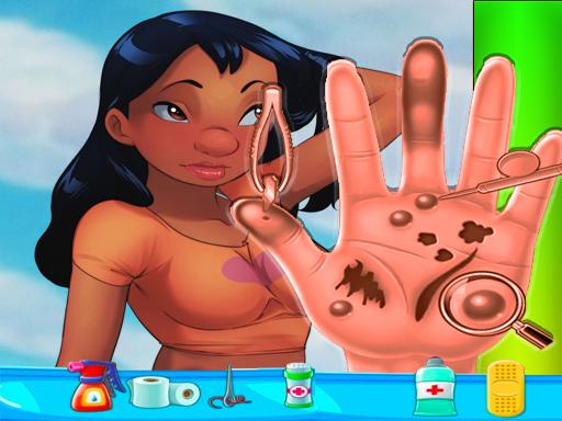 nani-pelekai-hand-doctor-game-online